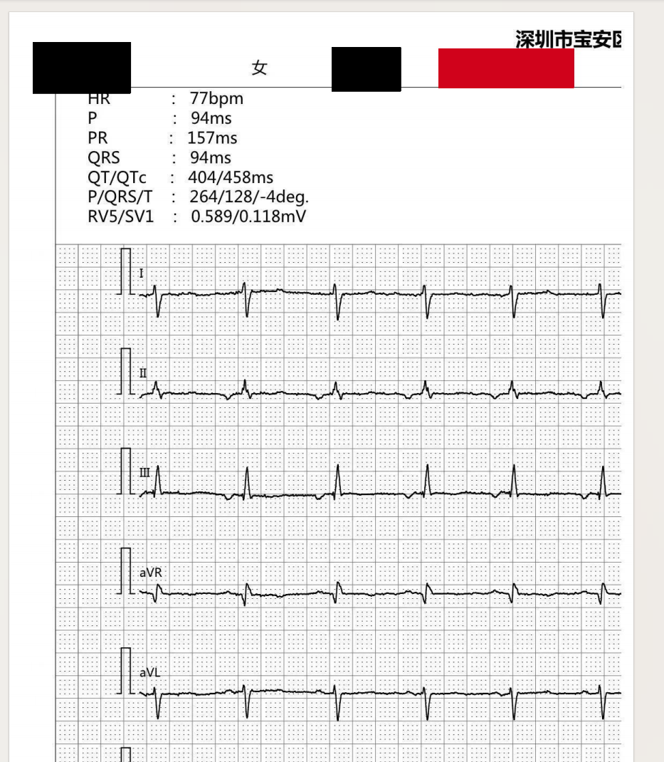 病例资料PDF批量脱敏效果预览