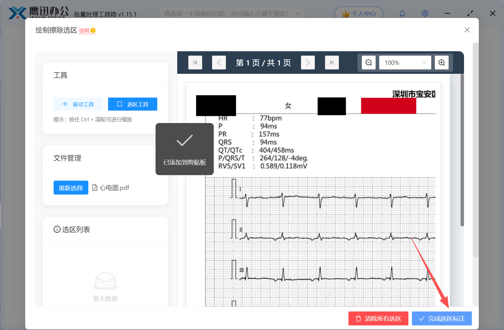 病例资料PDF批量脱敏完成选区绘制